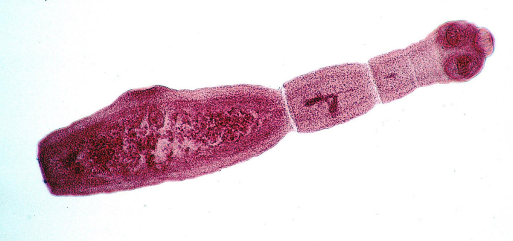 Adult Echinococcus multilocularis, a tapeworm. The tapeworm under the microscope is stained pink. 